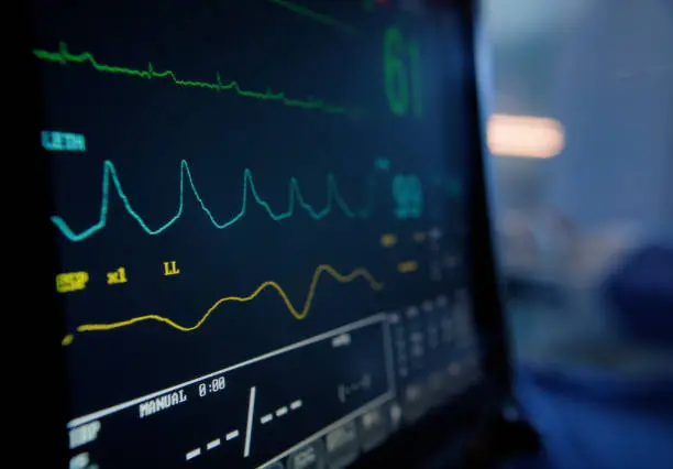 What do you dream about Electrocardiogram?